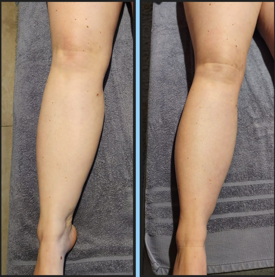Liquid Lymphatic Drainage – Slimmer Face, Lighter Legs, Flatter Belly